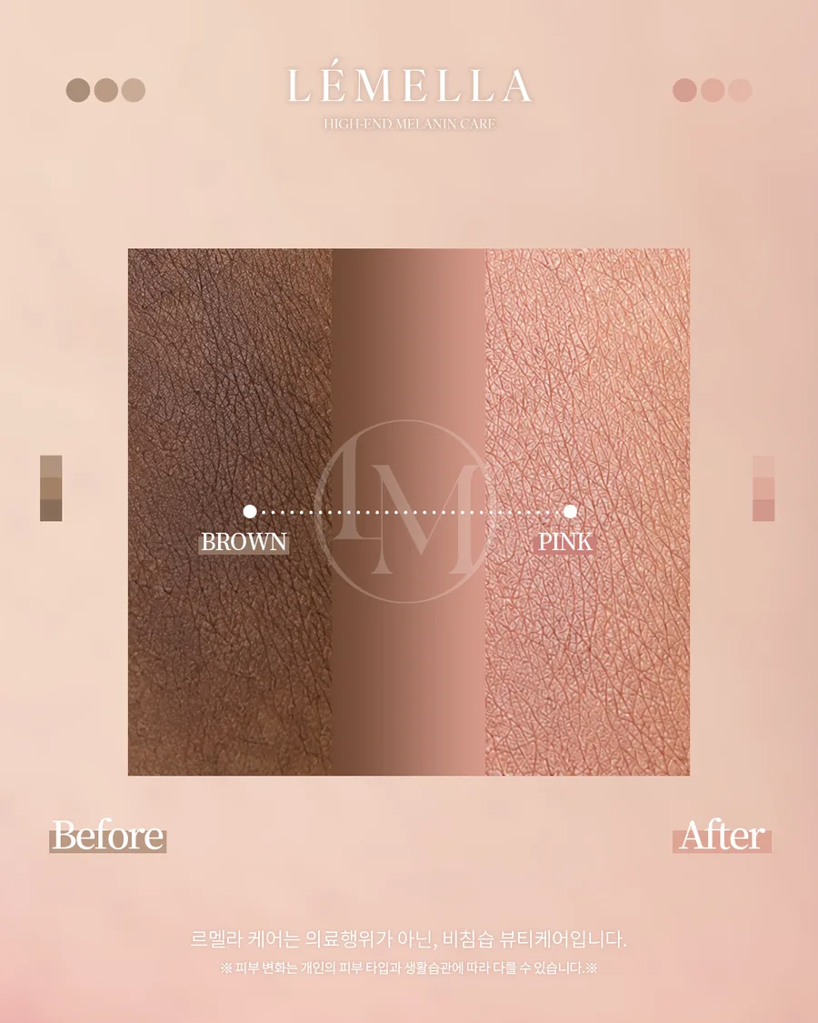 メラニンケア(ルメラ) Before After 施術例 7