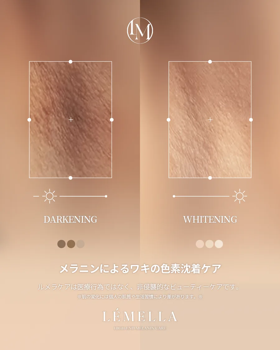 メラニンケア(ルメラ) Before After 施術例 12
